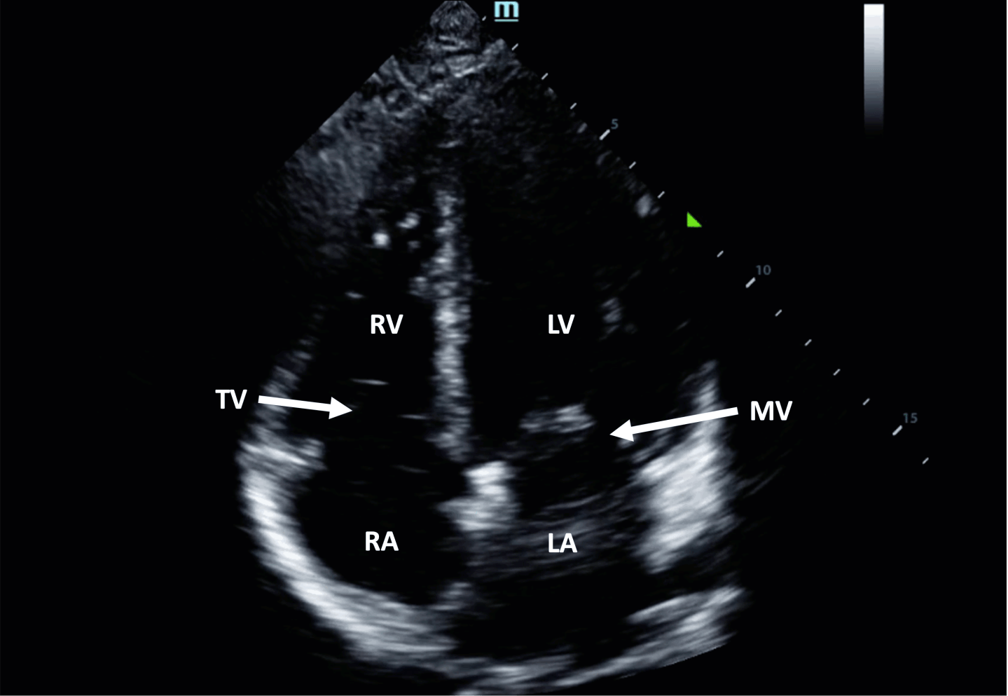 Cardiac Views – Toronto Internal Medicine POCUS